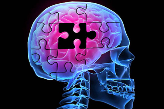 Τεστ για έγκαιρη διάγνωση του Αλτσχάιμερ